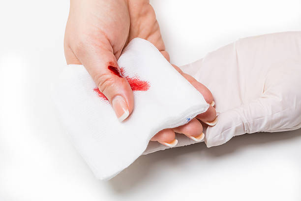 first aid - wound care stock photo