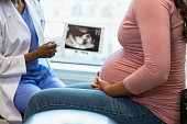 istock Focus on foreground as doctor shows ultrasound in background 1334856826