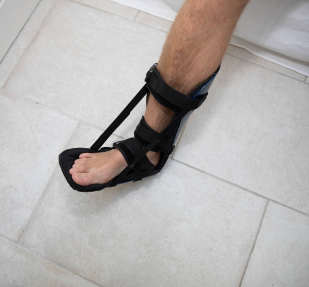 Foot in a leg splint to reduce the impact of Plantar Fasciitis or Drop Foot Foot in a leg splint to reduce the impact of Plantar Fasciitis or Drop Foot plantar fasciitis stock pictures, royalty-free photos & images