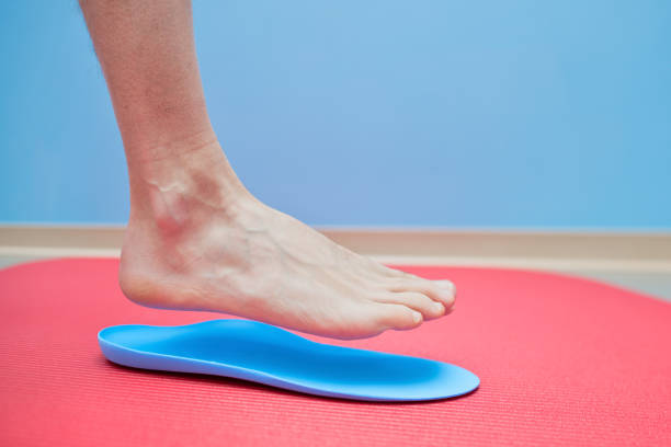 Foot on orthopedic insoles medical foot correction stock photo