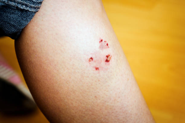 209 Dog Bite Wound Stock Photos, Pictures & Royalty-Free Images - iStock