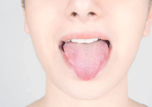 funny young woman mouth stock photo