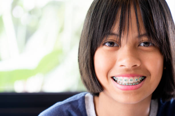 Girl with braces teeth smiling and happy stock photo