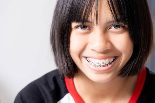 Girl with dental braces smiling and happy stock photo