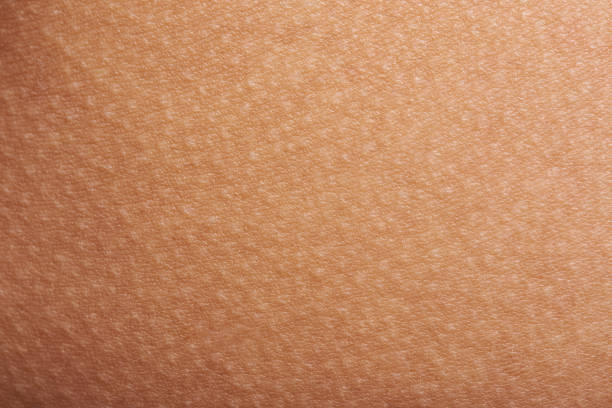 goose bumps on human skin Goose bumps on human skin closeup. Tecture of skin with goose bumps human skin close up stock pictures, royalty-free photos & images