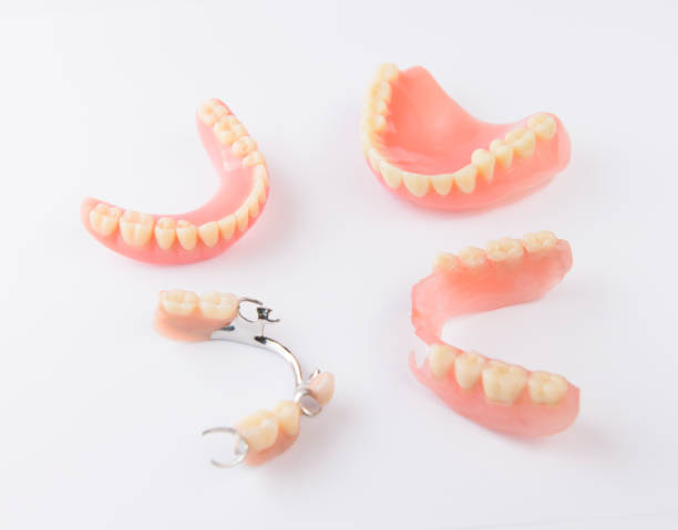 Group of dentures on white background stock photo