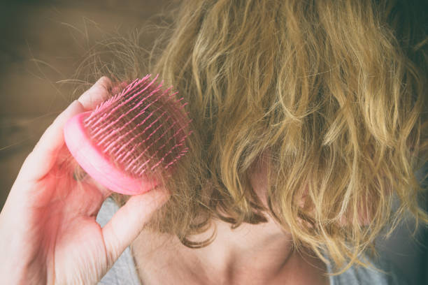 Hair loss problem brush with hair stock photo