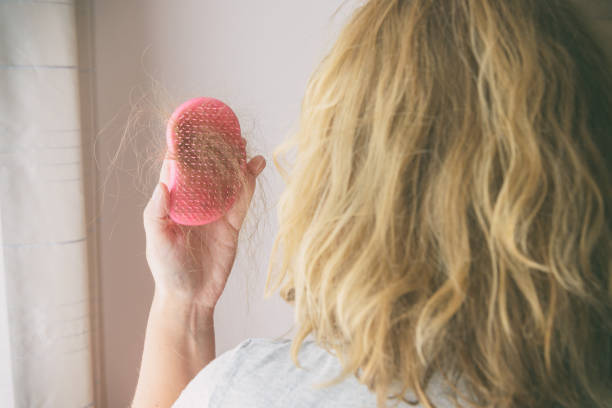 Hair loss problem brush with hair stock photo