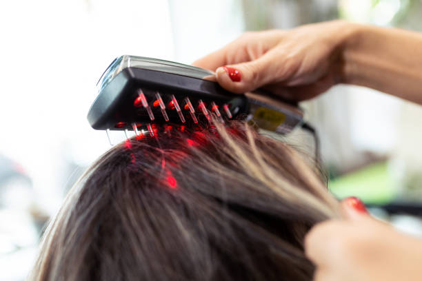 Hairdresser doing a treatment with ultrasonic and infrared laser comb for hair regrowth in her woman client at the salon. Close-up of hairdresser doing a treatment with ultrasonic and infrared laser comb for hair regrowth in her woman client at the salon. laser hair regrowth stock pictures, royalty-free photos & images