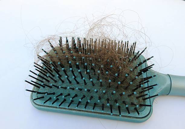 hairy brush Losing hair? Hair brush, complete with hair. hair regrowth stock pictures, royalty-free photos & images