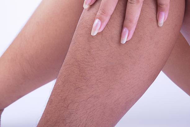 Why do women have hairy legs