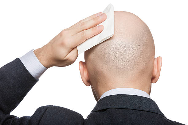 Hand holding tissue wiping or drying bald sweat head stock photo
