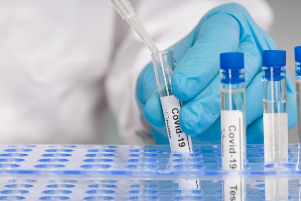 mano en guantes azules que trabajan con tubos de ensayo en el análisis de virus en un laboratorio médico - covid test fotografías e imágenes de stock