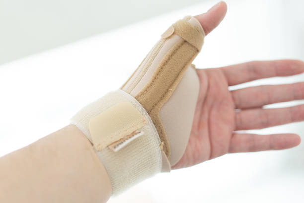 Hand in splint for tenosynovitis tendinitis or wrist sprain medical treatment stock photo