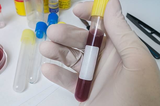 Hand of researcher holds test tube with sample of blood