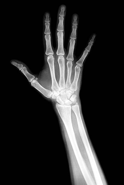 Hand X-Ray stock photo