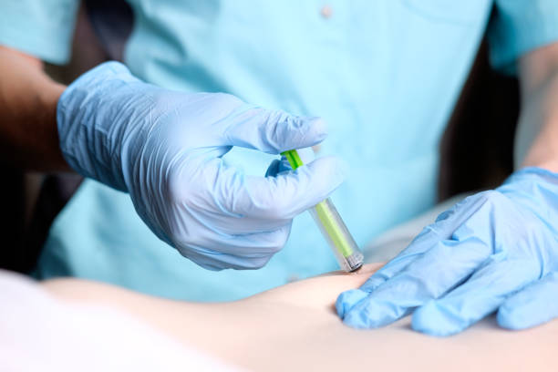 hands of nurse in blue surgical gloves making injection of anticoagulant subcutaneously stock photo