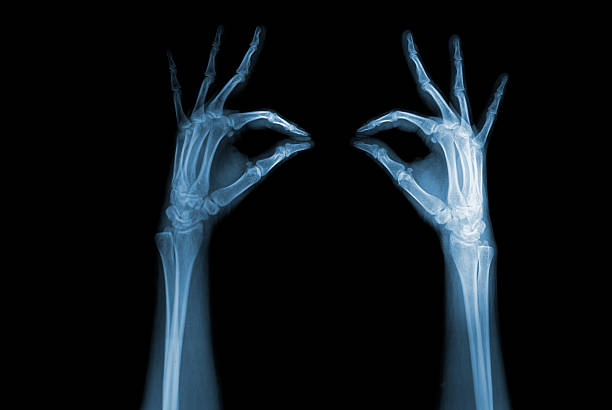 hands x-ray stock photo