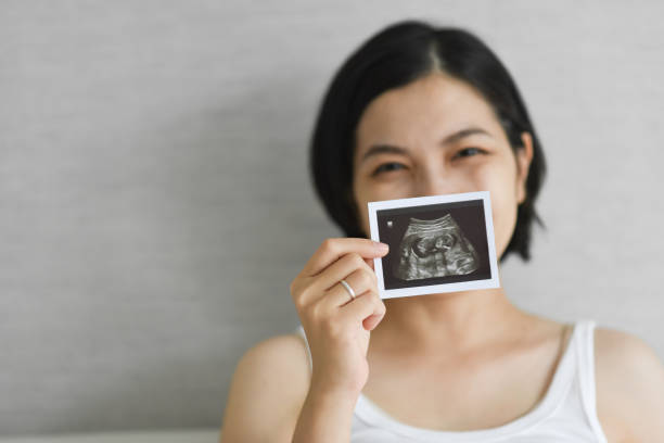 Happy Smiling Young Asian Pregnant woman holding showing ultrasound scan photo. stock photo