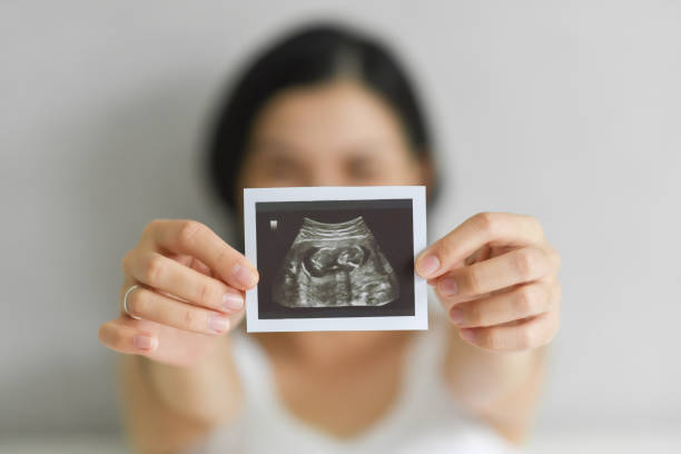 Happy Young Pregnant woman holding showing ultrasound scan photo. stock photo