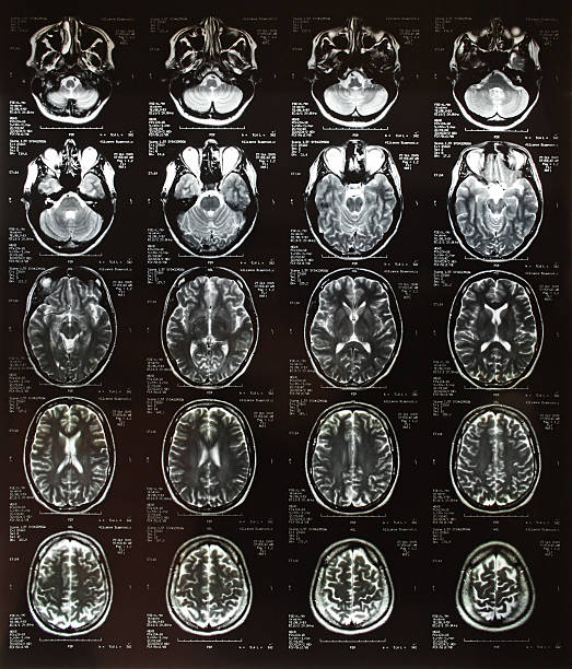 Head x-ray plates MRI brain scan. x ray plates stock pictures, royalty-free photos & images