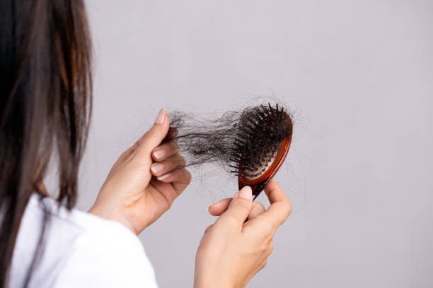 Healthy concept. Woman show her brush with damaged long loss hair and looking at her hair. stock photo