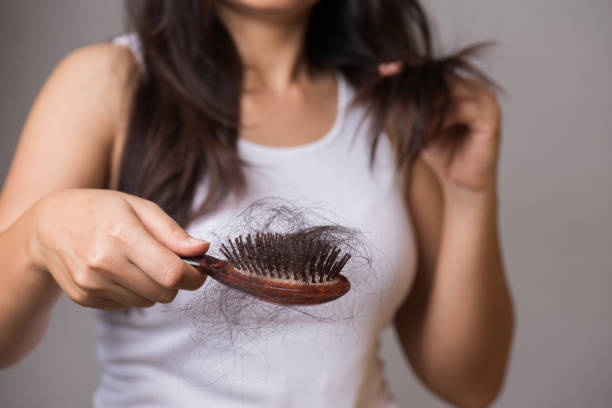 Healthy concept. Woman show her brush with long loss hair and looking at her hair. stock photo