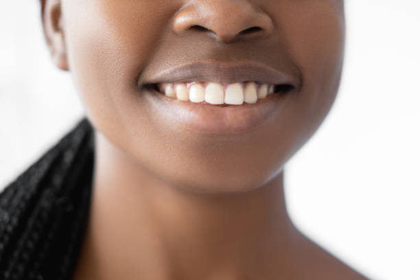 healthy smile dental care dentistry woman teeth stock photo