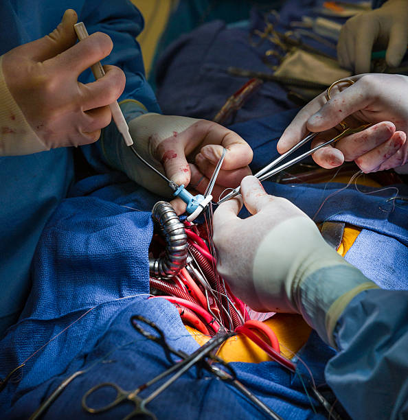 aortic valve heart surgery