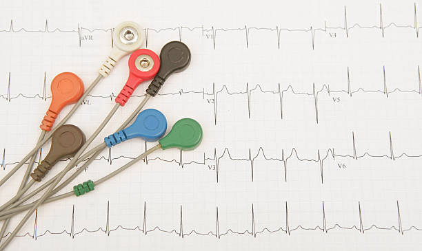 Heart Testing Sensors for a holter monitor on a printout of the resulting graph. electrode stock pictures, royalty-free photos & images