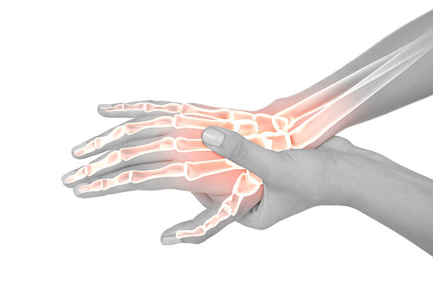 Highlighted bones of woman with hand pain Digital composite of Highlighted bones of woman with hand pain joint pain stock pictures, royalty-free photos & images