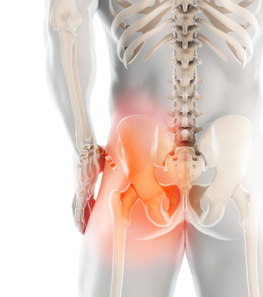 Hip painful skeleton x-ray, 3D illustration. 3D illustration, hip painful skeleton x-ray, medical concept. hip body part stock pictures, royalty-free photos & images