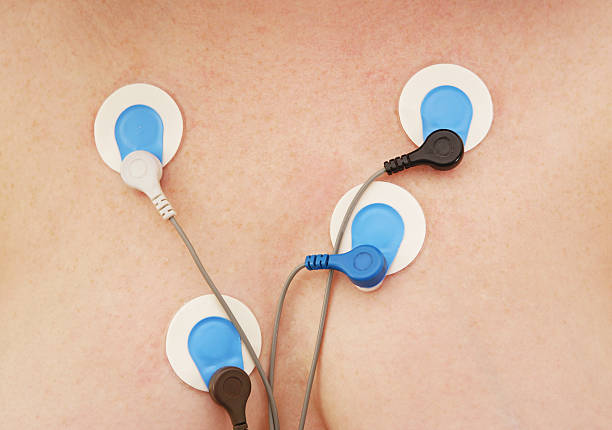 Holter Monitor Sensors Sensors for a Holter monitor on a woman's chest. electrode stock pictures, royalty-free photos & images