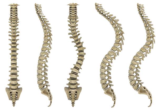 Human bones showing spine problems "Human bones showing spine problems like humpback, scolioses and  lordosis. On white background, great to be used in medicine works and health." cauda equina photos stock pictures, royalty-free photos & images