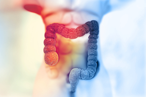 threat of colon cancers