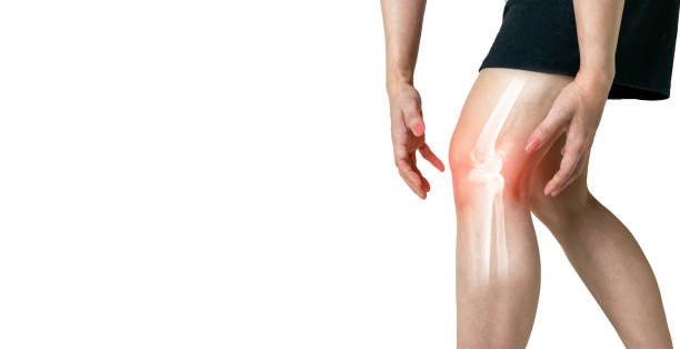 Human leg Osteoarthritis inflammation of bone joints on white background stock photo