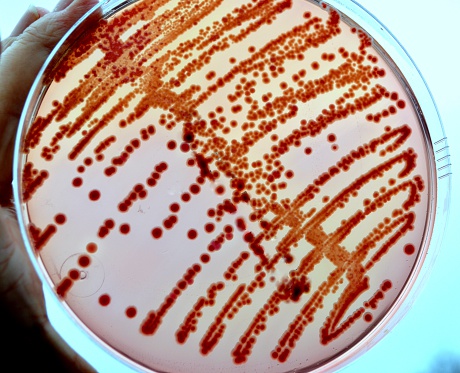Different enterobacteria grown over night on an agar plate against a blue background. These bacteria is a part of the normal human microbiome.