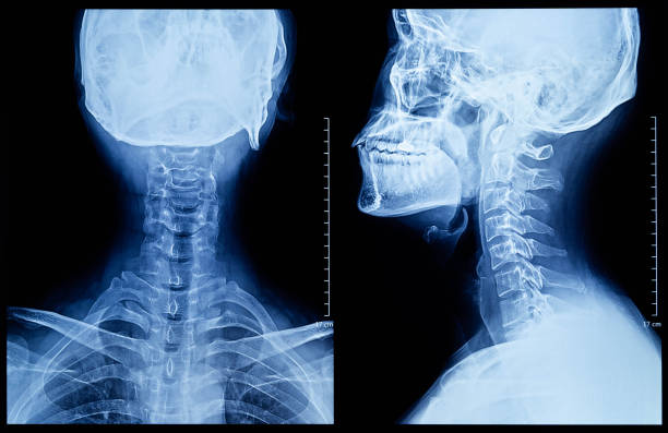 Human neck X-ray Film Human neck X-ray Film xray stock pictures, royalty-free photos & images
