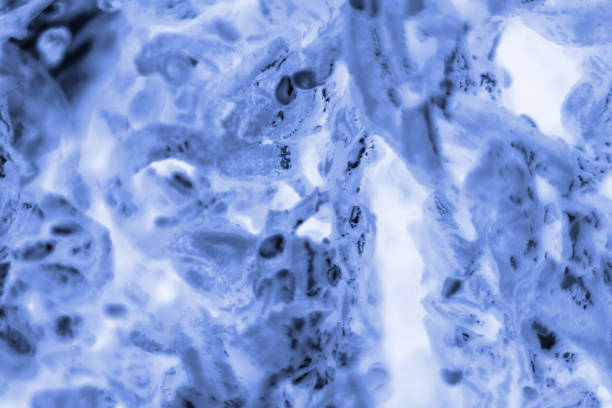 PC-3 human prostate cancer cells stained with blue Coomassie, under a differential interference contrast microscope. - Image stock photo