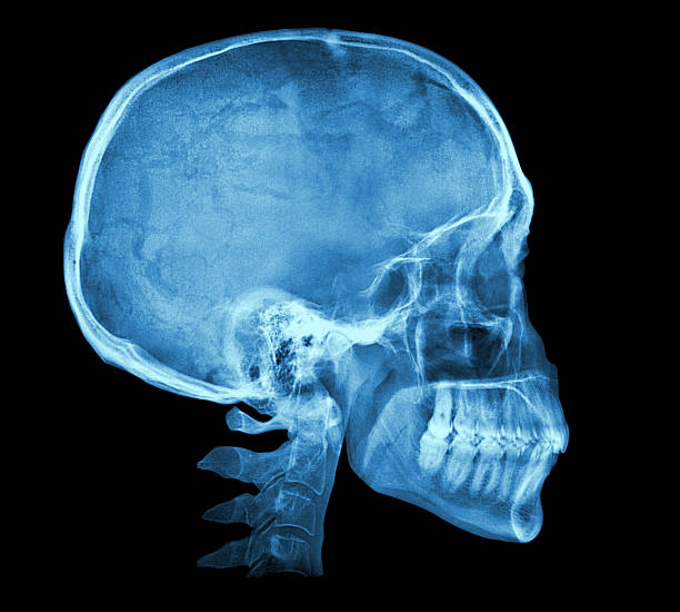 menschlicher schädel röntgenbild - röntgenbild stock-fotos und bilder