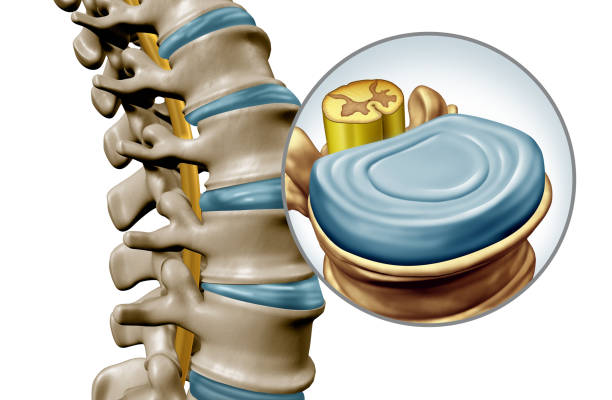 Human Spine Disk Anatomy Lumbar spine disk anatomy segment medical concept as a close up of the human back skeleton as a vertebral magnification with a spinal cord and disk as a 3D illustration isolated on white. cauda equina photos stock pictures, royalty-free photos & images