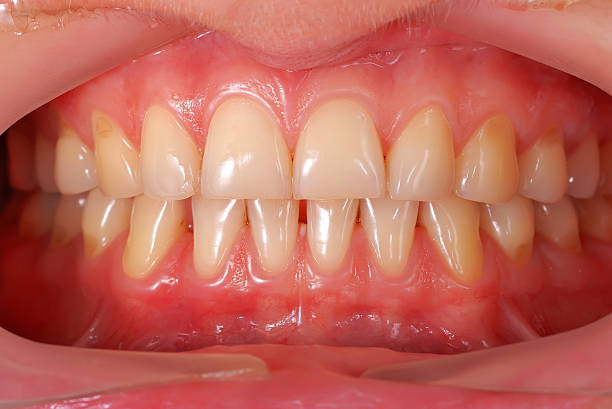 human teeth stock photo
