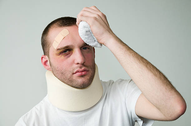 hurt young man  black eye stock pictures, royalty-free photos & images