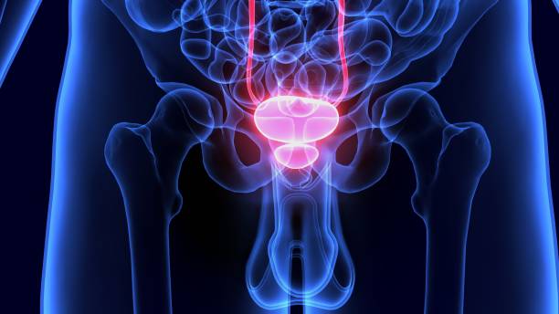 Metodă revoluţionară în tratarea cancerului de prostată: chirugie şi un cocteil de medicamente