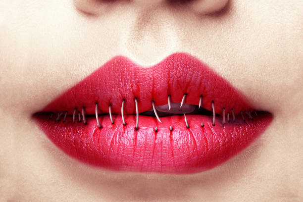 Illustration of idea that women reject remaining silent about sexual harassment. Illustration of lips that are stitched on one side and unstitched on the other. me too social movement stock pictures, royalty-free photos & images
