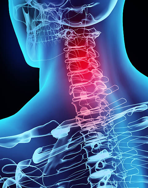 3D illustration x-ray neck painful. 3D illustration x-ray neck painful, medical concept. spine body part photos stock pictures, royalty-free photos & images