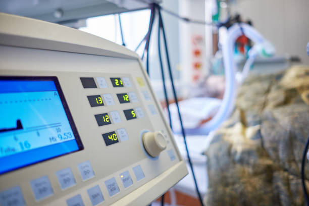 ALV in intensive care department, intubated patient in critical state. stock photo