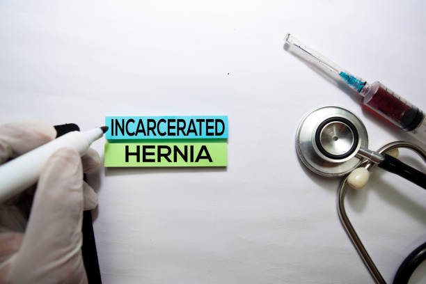 Incarcerated Hernia text on top view isolated on white background. Healthcare/Medical concept Incarcerated Hernia text on top view isolated on white background. Healthcare/Medical concept hernia inguinal stock pictures, royalty-free photos & images