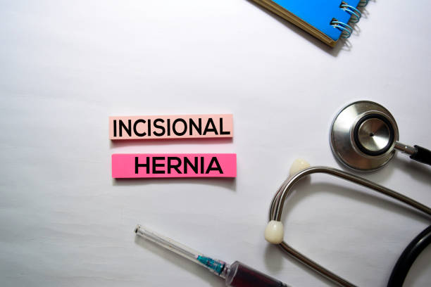 Incisional Hernia text on top view isolated on white background. Healthcare/Medical concept Incisional Hernia text on top view isolated on white background. Healthcare/Medical concept hernia inguinal stock pictures, royalty-free photos & images