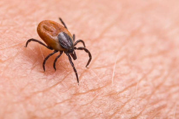 Infected female deer tick on hairy human skin. Ixodes ricinus. Dangerous mite detail. Acarus. Infectious borreliosis stock photo